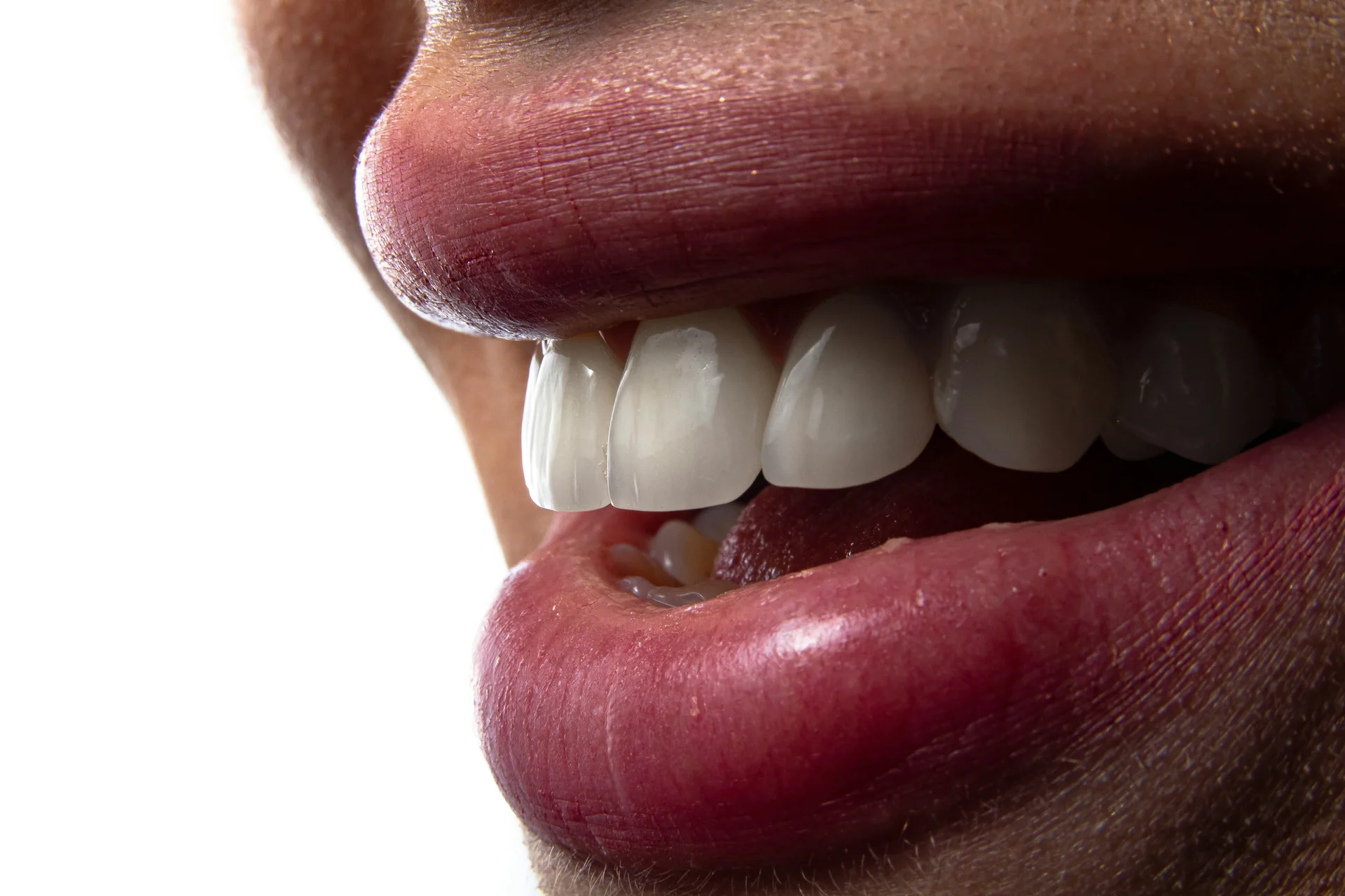 Sourire naturel illustrant les soins d’esthétique du sourire